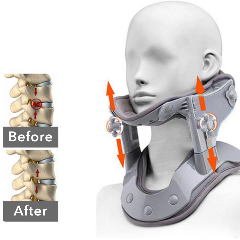 Collier pour cervicales|ÉquilibreCervical
